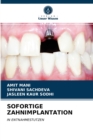 Sofortige Zahnimplantation - Book