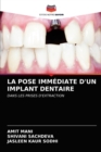 La Pose Immediate d'Un Implant Dentaire - Book