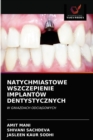 Natychmiastowe Wszczepienie Implantow Dentystycznych - Book
