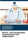 Weich- und Hartgewebe-Augmentation bei Implantaten - Book