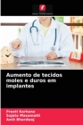 Aumento de tecidos moles e duros em implantes - Book