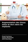 Augmentation des tissus mous et durs dans les implants - Book