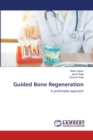 Guided Bone Regeneration - Book