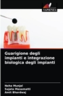 Guarigione degli impianti e integrazione biologica degli impianti - Book