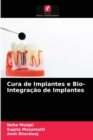 Cura de Implantes e Bio- Integracao de Implantes - Book