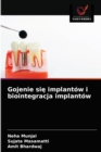 Gojenie si&#281; implantow i biointegracja implantow - Book