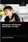 Mozgowe pora&#380;enie dzieci&#281;ce w Iraku - Book