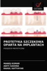 Protetyka Szcz&#280;kowa Oparta Na Implantach - Book