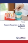 Recent Advances In Dental Implants - Book