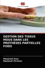 Gestion Des Tissus MOUS Dans Les Protheses Partielles Fixes - Book