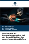 Implantate als Behandlungsoption bei der Rehabilitation des posterioren Oberkiefers - Book