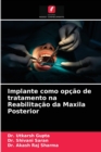 Implante como opcao de tratamento na Reabilitacao da Maxila Posterior - Book