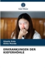 Erkrankungen Der Kieferhohle - Book