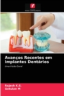 Avancos Recentes em Implantes Dentarios - Book