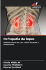 Nefropatia da lupus - Book