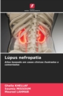 Lupus nefropatia - Book