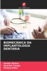 Biomecanica Da Implantologia Dentaria - Book