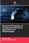 Avancos Recentes na Preparacao Dentaria Operativa em Odontologia - Book
