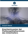 Knocheninvasion bei Plattenepithelkarzinom des Unterkiefers - Book