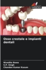 Osso crestale e impianti dentali - Book