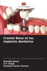 Crestal Bone et les implants dentaires - Book