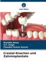 Crestal-Knochen und Zahnimplantate - Book