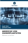 Abdrucke Von Zahnimplantaten - Book