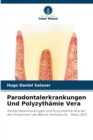 Parodontalerkrankungen Und Polyzythamie Vera - Book