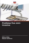 Prothese fixe mini-invasive - Book