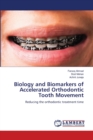Biology and Biomarkers of Accelerated Orthodontic Tooth Movement - Book
