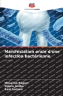 Manifestation orale d'une infection bacterienne - Book