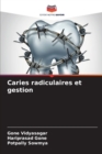 Caries radiculaires et gestion - Book