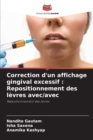 Correction d'un affichage gingival excessif : Repositionnement des levres avec/avec - Book