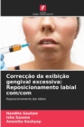 Correccao da exibicao gengival excessiva : Reposicionamento labial com/com - Book