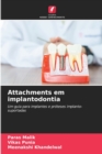 Attachments em implantodontia - Book