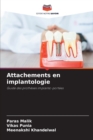 Attachements en implantologie - Book