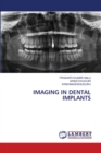 Imaging in Dental Implants - Book