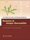 Eczema and Atopic Dermatitis - Book