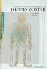 Acupuncture and Moxibustion for Herpes Zoster - Book