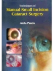Techniques of Manual Small Incision Cataract Surgery - Book