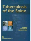 Tuberculosis of the Spine - Book