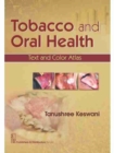Tobacco and Oral Health : Text and Color Atlas - Book