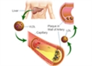 Estimation of Blood LDL Cholesterol and VLDL Cholesterol - eBook