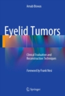 Eyelid Tumors : Clinical Evaluation and Reconstruction Techniques - eBook