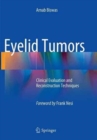 Eyelid Tumors : Clinical Evaluation and Reconstruction Techniques - Book
