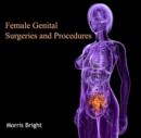 Female Genital Surgeries and Procedures - eBook