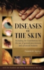 Diseases of the Skin : Including the Exanthemata for the Use of General Practitioners & Advanced Students - Book