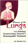Diseases of Lungs - Book