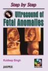 Step by Step Ultrasound of Fetal Anomalies - Book