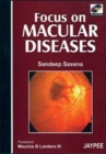 Focus on Macular Diseases - Book